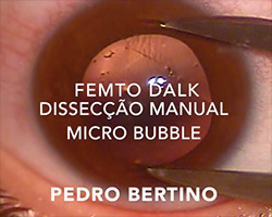 Dr. Pedro Bertino Oftalmologia